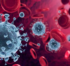 COVID-19 erhöht bei Patienten mit hämatologischen Krebserkrankungen Morbidität und Mortalität