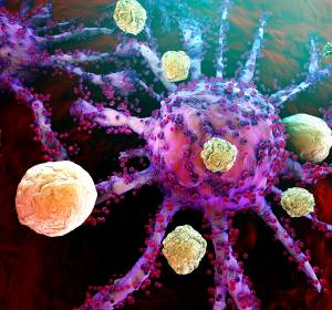 Neuartige Krebsimmuntherapie: Universitätsklinikum Halle behandelt Lymphdrüsenkrebs-Betroffene mit CAR-T-Zell-Therapie