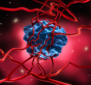 Tumorzellen: Programmierter Zelltod durch synthetische RNA-Moleküle