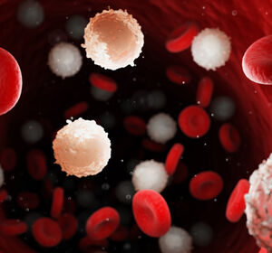 AML und MM: Längeres Überleben mit Azacitidin und CAR-T-Zellen