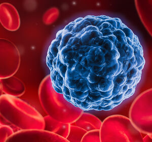 Ist die restlose Entfernung von Tumorzellen aus Operationsblut möglich?
