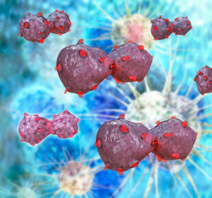 HIV und Krebs: Früher Beginn antiretroviraler Therapie senkt Risiko 