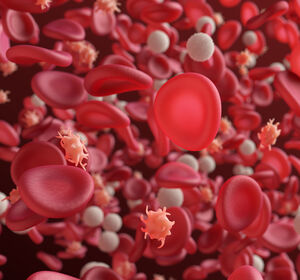 Polycythaemia Vera: Thromboserisiko mit KI senken?