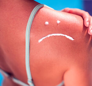 Risiko Sonnenstudio – Inzidenz von Hauttumoren im Kopf- und Halsbereich steigt