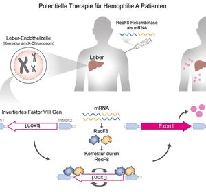 Hämophilie A: Designer-Rekombinase kann Gen-Defekt korrigieren