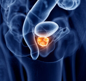 Prostatakarzinom: Ist eine nicht-invasive Diagnostik möglich?