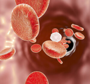 Myelofibrose: Beeinflusst eine frühere Ruxolitinib-Therapie das Gesamtüberleben?