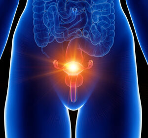Endometriumkarzinom: Frühzeitiger Test auf genetische Instabilität