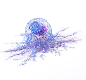 Checkpoint-Inhibition bei soliden Tumoren: Immunonkologie erobert immer frühere Therapielinien