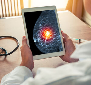 Röntgenkontrastmittel erhält Zulassungserweiterung für kontrastmittelverstärkte Mammographie