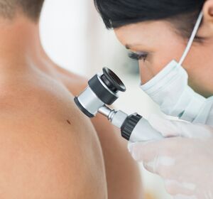 Interview: Immuntherapien bei Hautkrebs