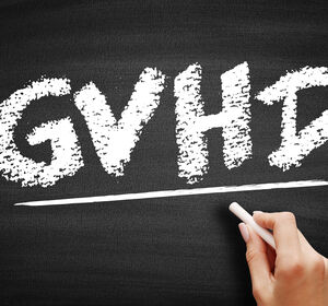 GvHD: Bei Steroidrefraktärität früh auf JAK-Inhibition setzen