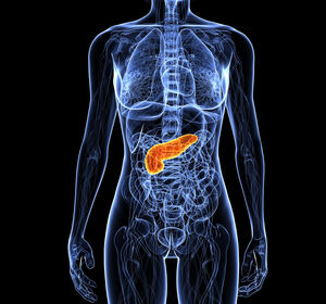 Metabolismus von Tumorzellen des Pankreaskarzinoms