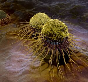 Flatliner-Krebszellen: Weiterleben trotz Zelltod-Signal
