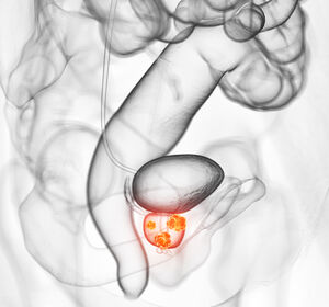 Fortgeschrittenes hormonsensitives Prostatakarzinom: Relugolix in der 3-Monatspackung