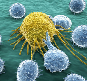 Melanom, Brustkrebs und Nierenzellkarzinom: Immuntherapie bewährt sich auch im adjuvanten Setting