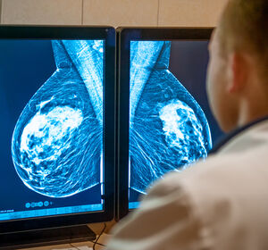 Studie untersucht Risiko für Serome nach Brustkrebs-OP
