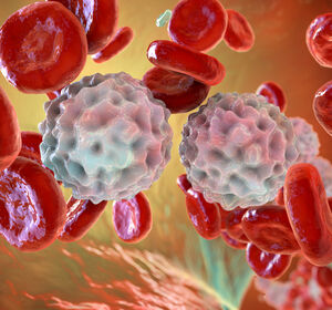 r/r LBCL: Baseline-Immunstatus und klonale Kinetik der T-Zellen assoziiert mit Ansprechen auf Axi-cel