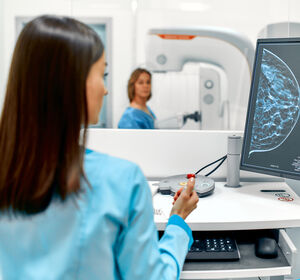 Brustkrebs-Früherkennung: Wirksamkeit der Kombination aus Tomosynthese und synthetischer Mammografie bestätigt