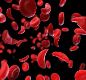 Exa-cel: Geneditierung bietet neue Therapieoptionen bei Hämoglobinopathien