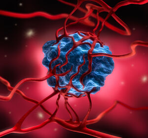 NSCLC und Magenkarzinom: Anti-Angiogenese stimuliert das Immunsystem