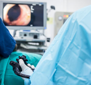Koloskopie: KI-unterstützte optische Diagnose von Darmpolypen