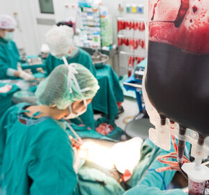 Blood Management: Neues Verfahren entfernt Tumorzellen effektiv