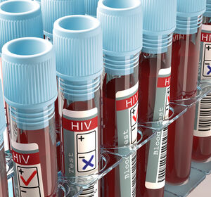 Ungleichbehandlung: HIV-positive Menschen mit DLBCL brauchen Zugang zu CAR-T-Zelltherapien