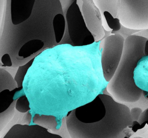 3D-Zellkultursystem soll Prostatakarzinom-Forschung vereinfachen