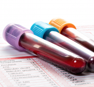 Bluttest zur Darmkrebsvorsorge in USPSTF-Empfehlungen aufgenommen