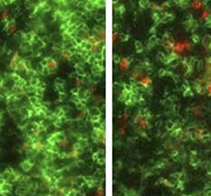 Graft-versus-Host-Erkrankung nach Stammzelltransplantation verhindern