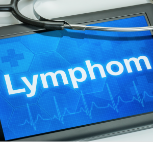 Studie zu T-Zell-Lymphom: Stammzelltransplantation nach Chemotherapie verbessert Prognose