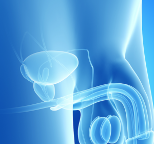 ASTRO 2016: Exzellente Tumorkontrolle bei Prostatakrebs mit stereotaktischer Bestrahlung