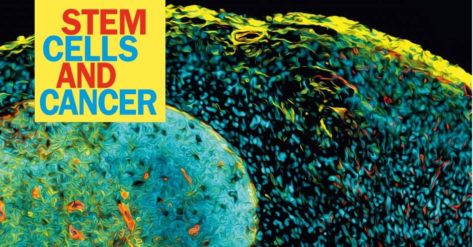 Krebsstammzellen: Von der Grundlagenforschung zu innovativen Behandlungsstrategien
