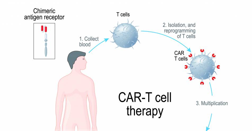 Neue Zelltherapie gegen Krebs