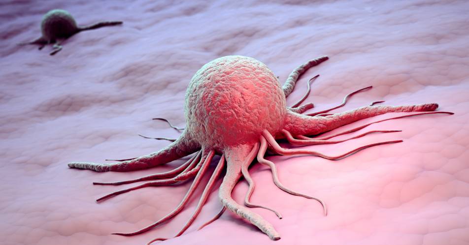 Metaanalyse: Residuelle Tumorlastmessung ermöglicht Aussagen zum Outcome nach neoadjuvanter Brustkrebstherapie