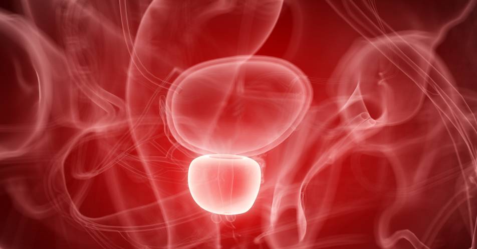 Prostatakarzinom: Krankheitskontrolle durch radiochirurgische Behandlung