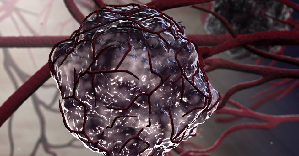 Krebszellen: Unsichtbar für das Immunsystem