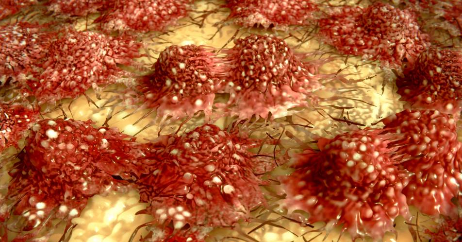 Metastasen: Ursache Makrophagen?