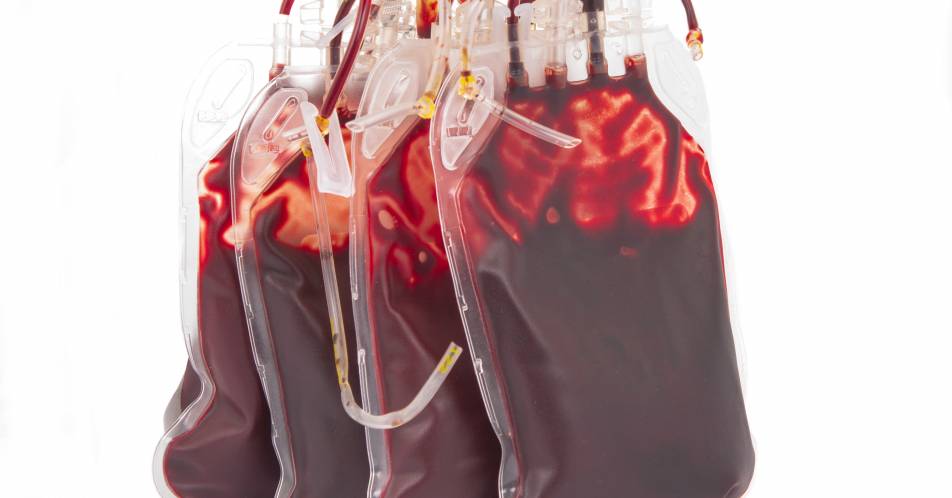 MEDALIST: Luspatercept verringert Anzahl an Transfusionen bei Patienten mit Low-risk-MDS und hohem Transfusionsbedarf