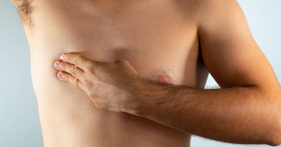 Männer mit Brustkrebs: Schlechter versorgt als Frauen?