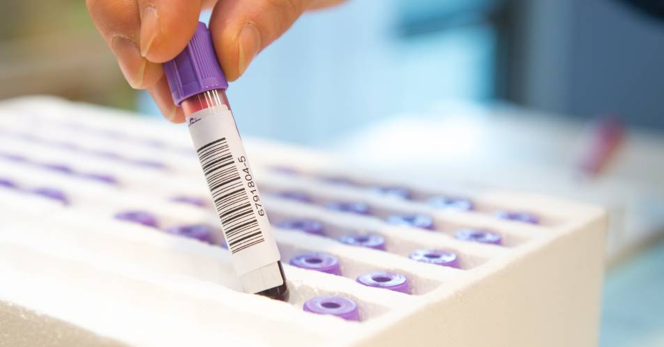 Biomarker-Testung unterstützt Identifizierung von NTRK-Fusions-positiven Patienten 