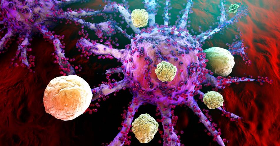 Neuartige Krebsimmuntherapie: Universitätsklinikum Halle behandelt Lymphdrüsenkrebs-Betroffene mit CAR-T-Zell-Therapie