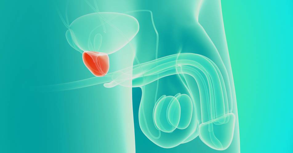 Prostatakarzinom: Nutzen PSMA-bindender Wirkstoffe für Diagnostik und Therapie
