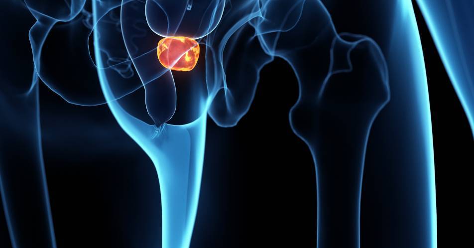 Prostatakarzinom: Nutzen der Fusionsbiopsie nicht ausreichend belegt