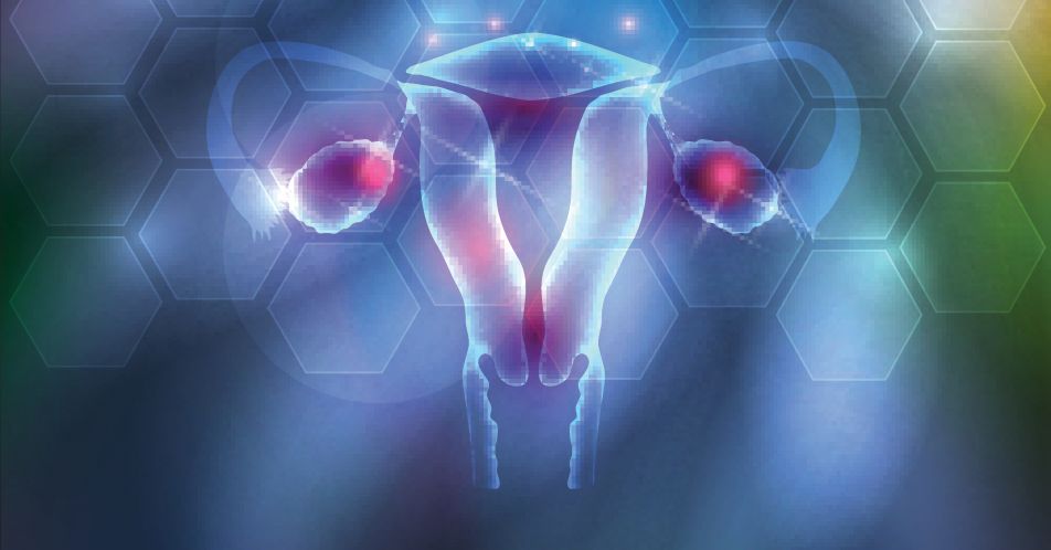 Ovarialkarzinom mit BRCA-Mutation: Verbessertes Überleben unter Rucaparib im Vergleich zur Standard-Chemotherapie