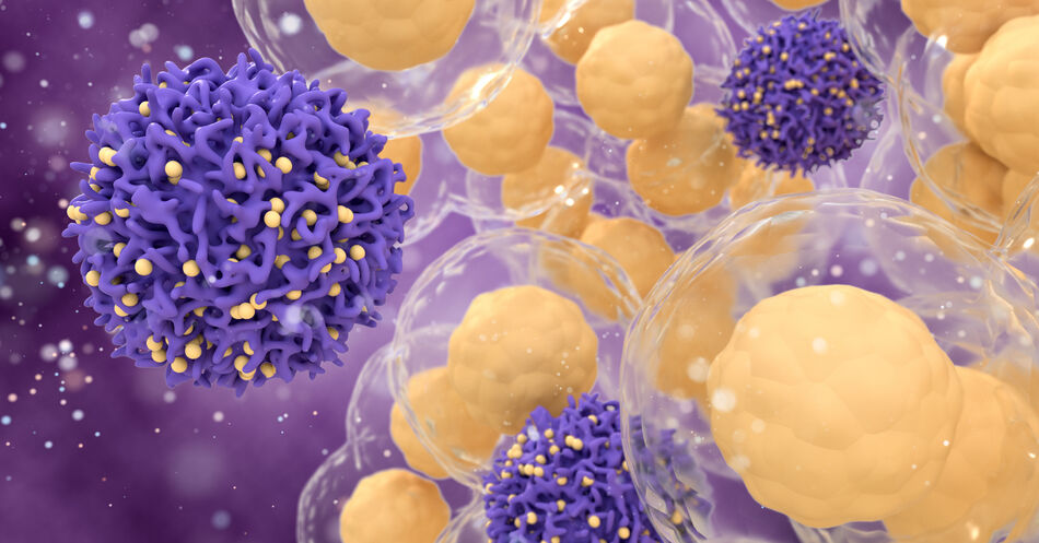 Seltene Krebserkrankungen: Molekulare Analyse unterstützt Therapieentscheidung