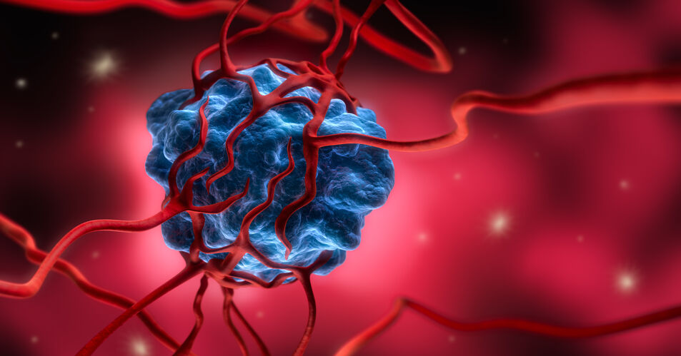 Tumorzellen: Programmierter Zelltod durch synthetische RNA-Moleküle