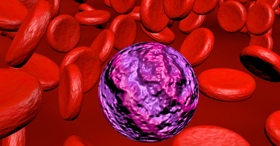 Bluterkrankungen: Höhere Heilungschancen mit CAR-T-Zelltherapie