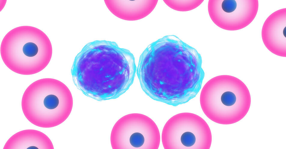 ALCL: BATF3 – Schlüsselrolle beim Wachstum der Tumorzellen